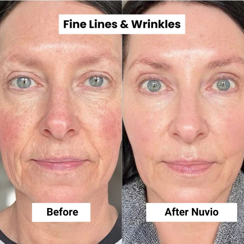 Nuvio Vegan Micro-Infusion Treatment