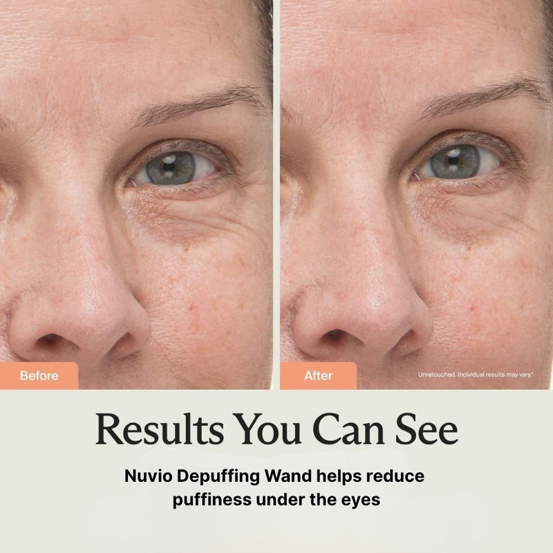 Nuvio Depuffing-staf