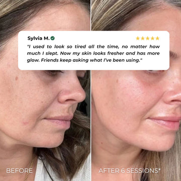 Nuvio EMS Patch Full Face Set